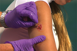 blessure-vie-marine-dan-marine-life-injuries.png